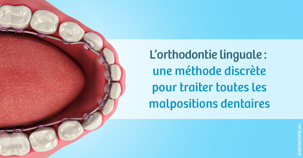 https://dr-khoury-georges.chirurgiens-dentistes.fr/L'orthodontie linguale 1