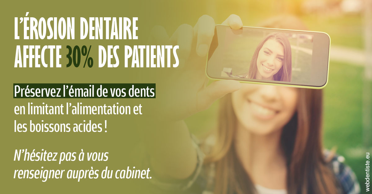 https://dr-khoury-georges.chirurgiens-dentistes.fr/L'érosion dentaire 1