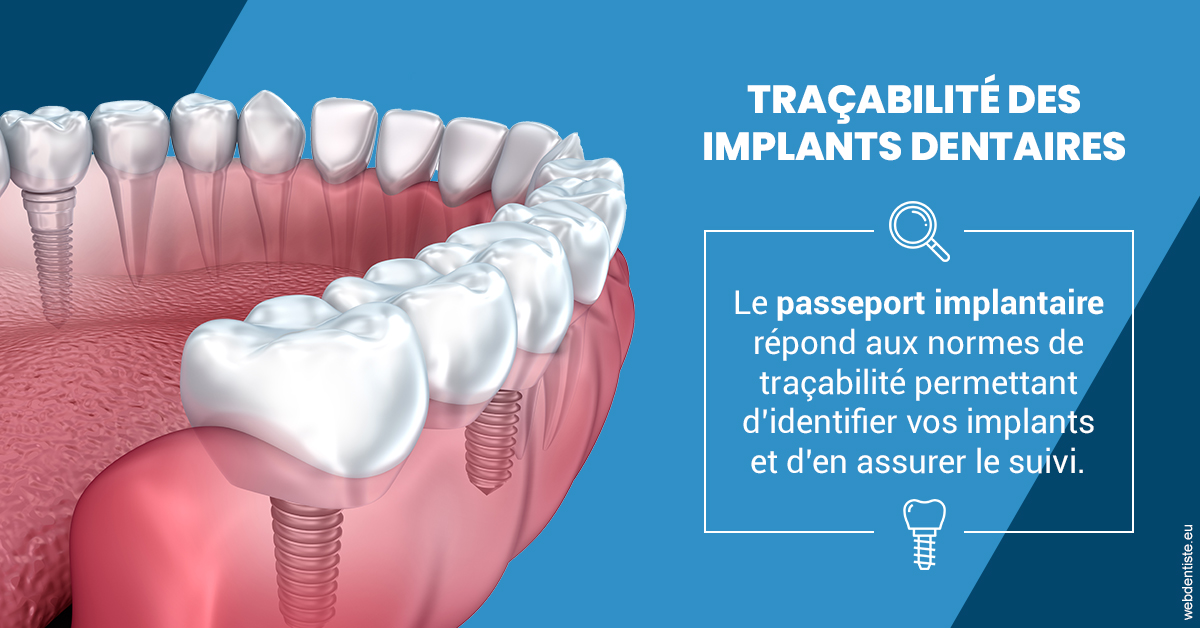 https://dr-khoury-georges.chirurgiens-dentistes.fr/T2 2023 - Traçabilité des implants 1