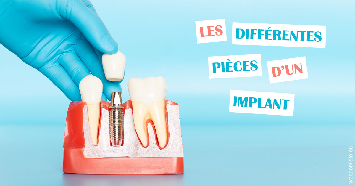https://dr-khoury-georges.chirurgiens-dentistes.fr/Les différentes pièces d’un implant 2
