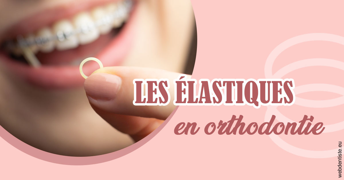 https://dr-khoury-georges.chirurgiens-dentistes.fr/Elastiques orthodontie 1