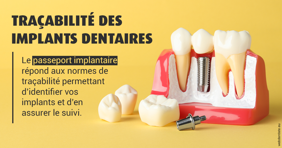 https://dr-khoury-georges.chirurgiens-dentistes.fr/T2 2023 - Traçabilité des implants 2