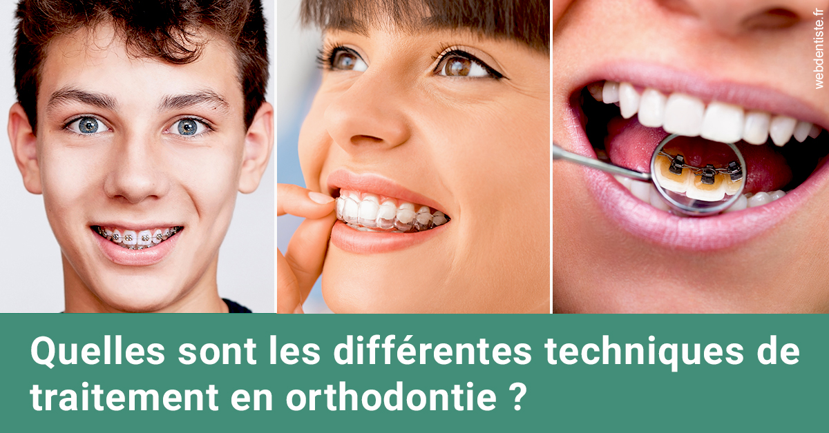 https://dr-khoury-georges.chirurgiens-dentistes.fr/Les différentes techniques de traitement 2