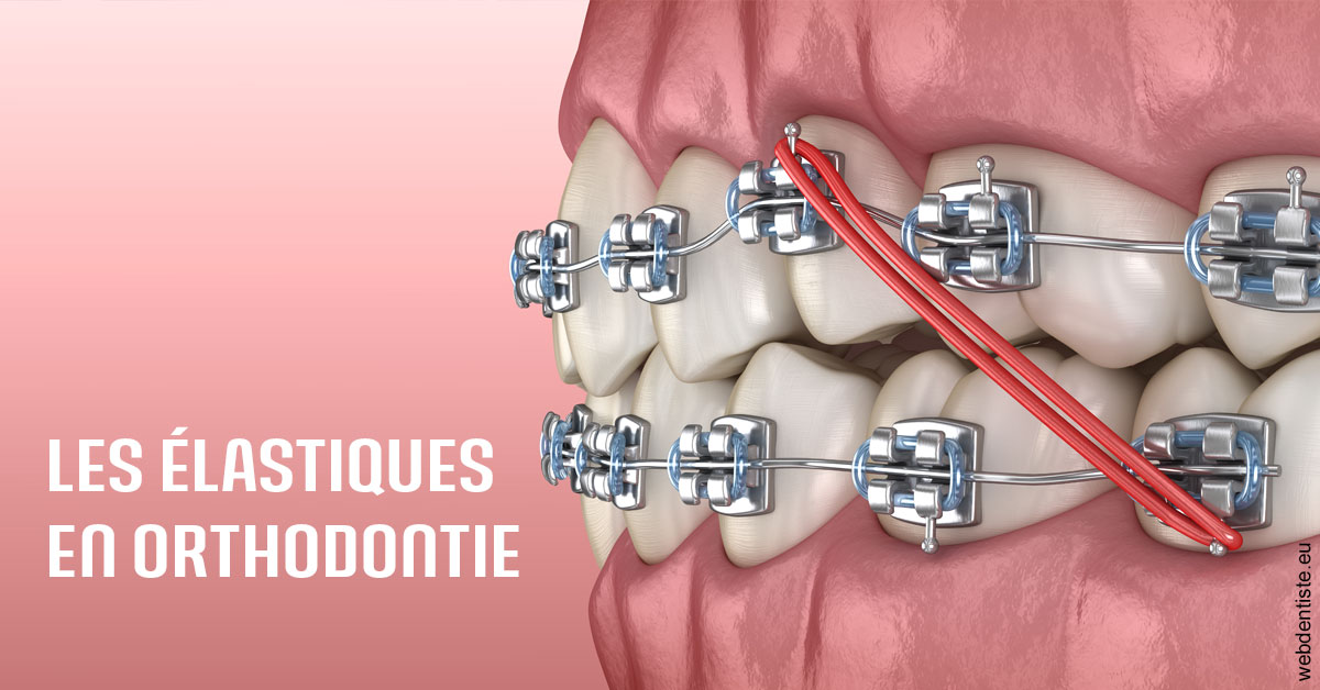https://dr-khoury-georges.chirurgiens-dentistes.fr/Elastiques orthodontie 2