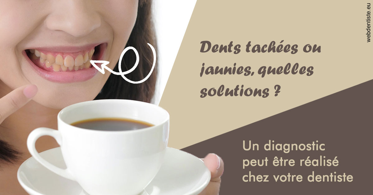 https://dr-khoury-georges.chirurgiens-dentistes.fr/Dents tachées 1