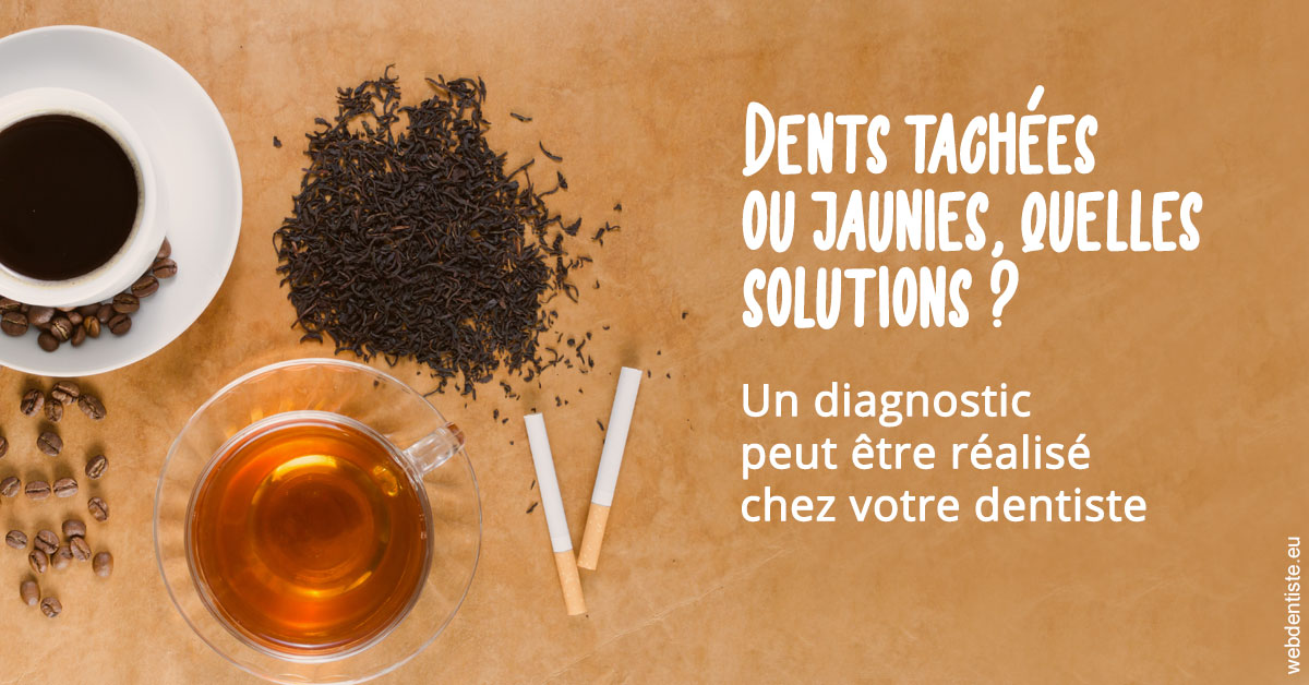 https://dr-khoury-georges.chirurgiens-dentistes.fr/Dents tachées 2