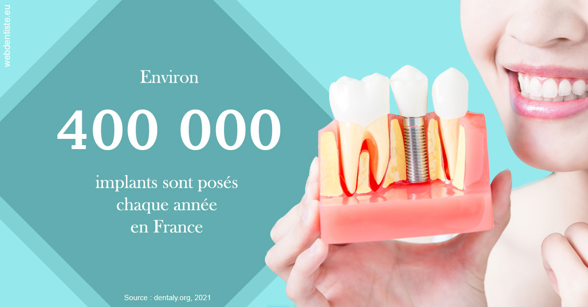 https://dr-khoury-georges.chirurgiens-dentistes.fr/Pose d'implants en France 2